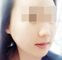 两周，接受术后管理后