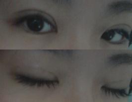 2012年初， 我做了埋线双眼皮手术~~大爱我的双眼皮