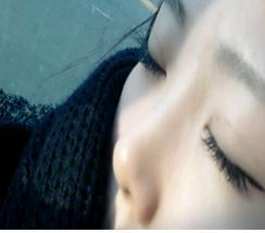 2012年初， 我做了埋线双眼皮手术~~大爱我的双眼皮