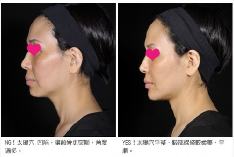 苹果机填充起来了,脸颊有丰润的感觉了!