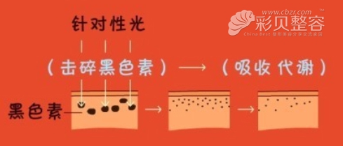 彩光美白