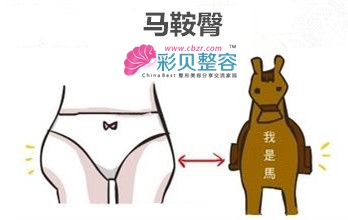 马鞍臀