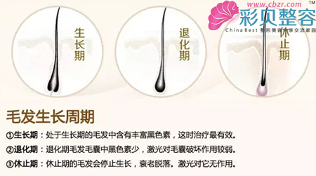 冰点脱毛前后对比