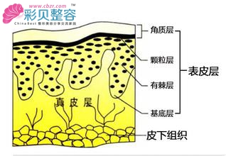 注射