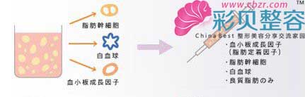 自体脂肪丰卧蚕