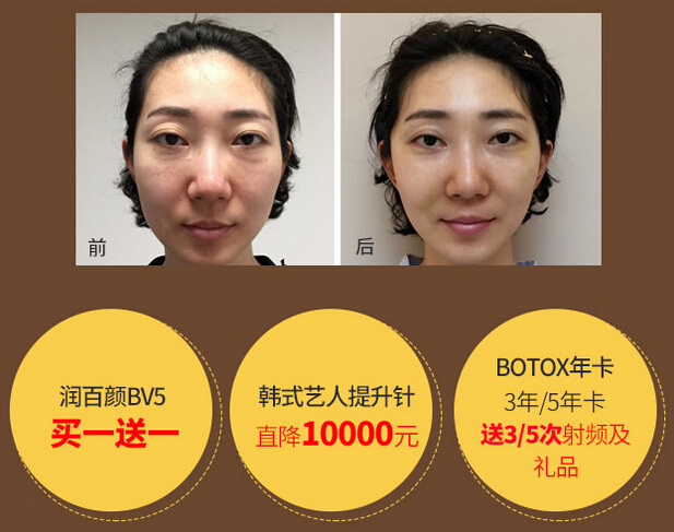 注射提升针价格优惠图