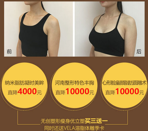 丰胸面雕脂肪移植优惠价格图