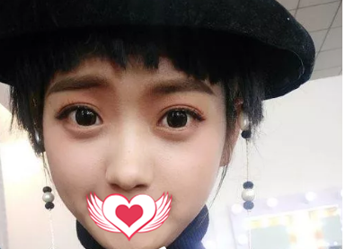 从来都没有想象过自己的眼睛可以变得这么美，谢谢医生