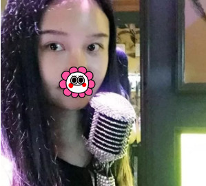 杭州瑞丽双眼皮+面部脂肪填充术后2周