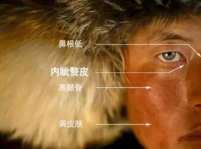 人普遍有内资赘皮