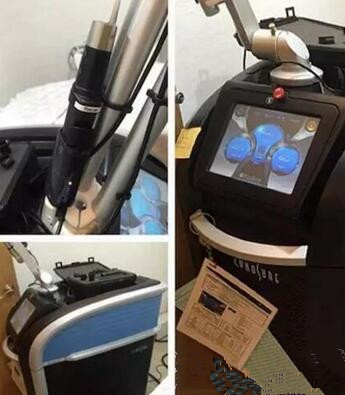 徐州心源整形皮秒激光设备