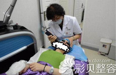 激光祛斑手术治疗中
