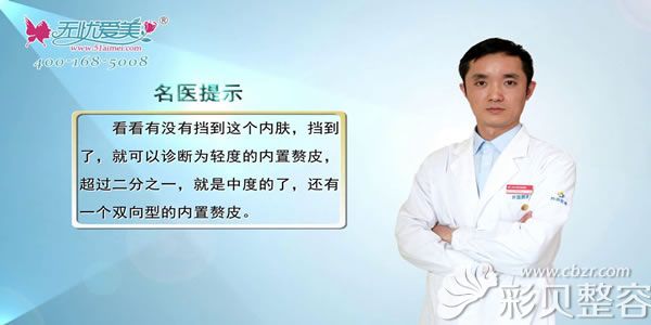 上海天大整形医院熊俊文医生讲如何区分是否有内、外眦赘皮