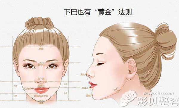 假体垫下巴 假体垫下巴