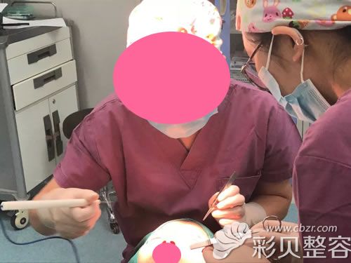 深圳阳光整形医院王勇院长给我做无痕双眼皮手术过程分享