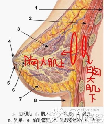隆胸假体植入分为胸大肌上和下