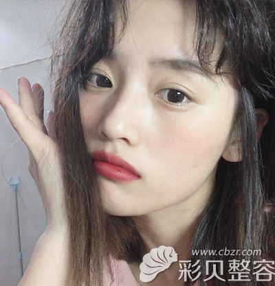 术后40天.jpg