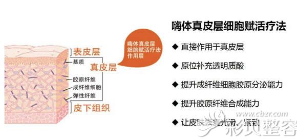 注射嗨体原理图