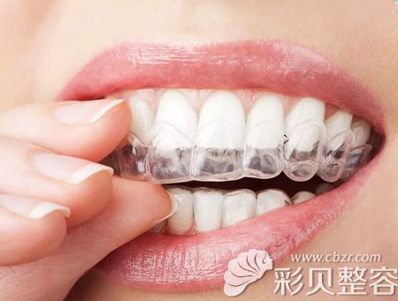 茂名华美牙齿美容医生江敏牙齿整形技术优势