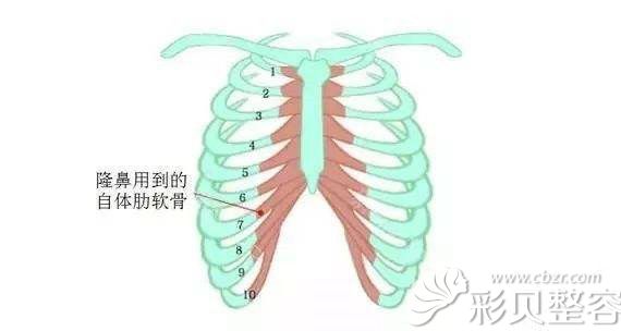 肋软骨隆鼻取骨位置