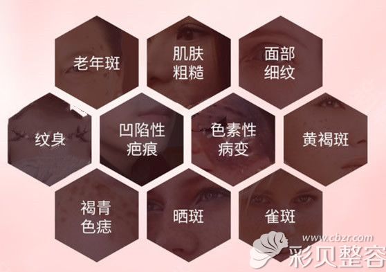 永州倾城严兴萍治疗项目