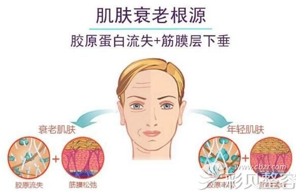 肌肤衰老从胶原蛋白流失开始