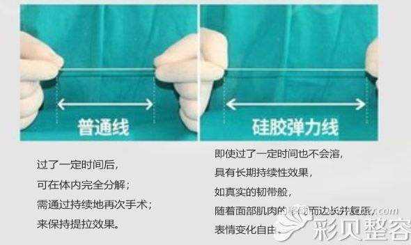 硅胶弹力线和普通提升线的区别 硅胶弹力线和普通提升线的区别