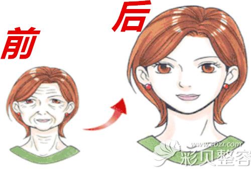 面部衰老前后对比图 面部衰老前后对比图