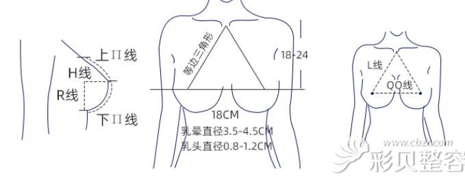 闫宏山隆胸技术优势