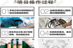 看一下广州李宗磊医生做自体脂肪丰胸注射一次效果如何？