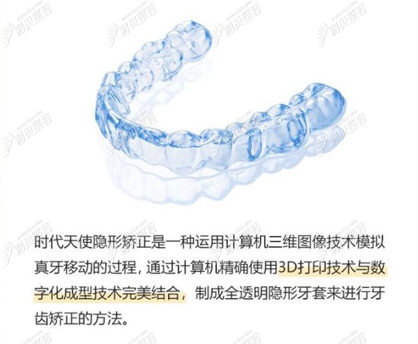 什么是时代天使隐形矫正