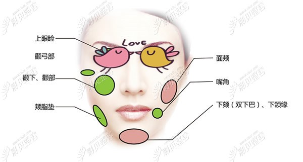 面部可以做5g天使光雕的部位