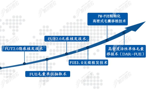 济南海峡植发技术有哪些