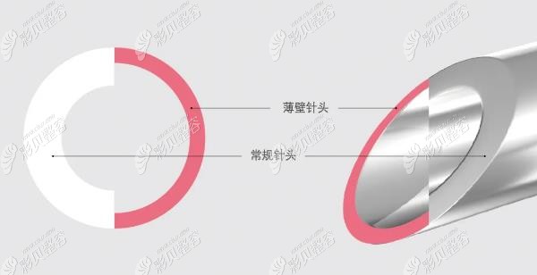 莫娜丽莎玻尿酸针头与普通玻尿酸针头区别