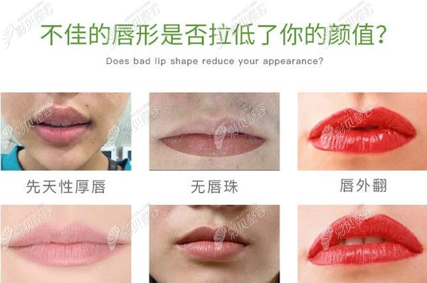 不好看的唇形有哪些
