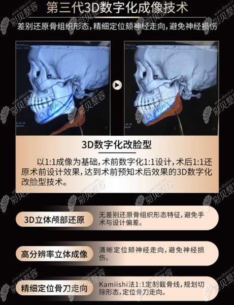 武汉华美第三代3D数字化成像技术