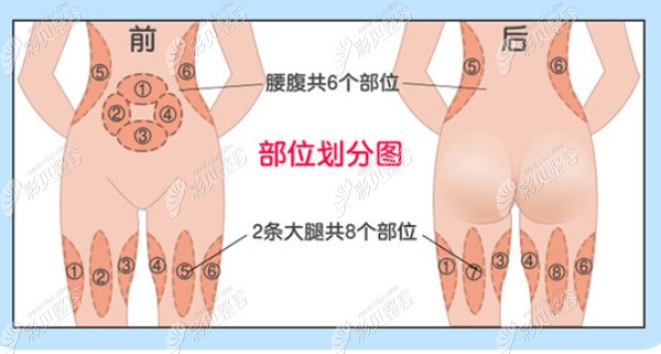 大腿吸脂8个部位图片