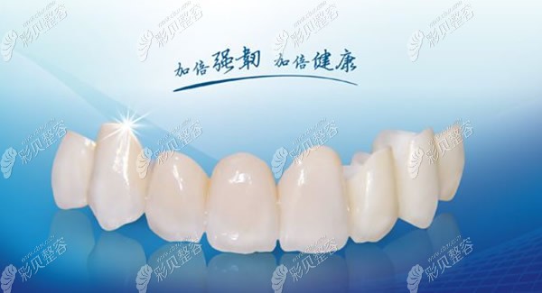 爱尔创全瓷牙和自然牙的色泽相近