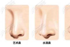 上海隆鼻口碑好的医生推荐：做鼻子风格自然、性价比还高