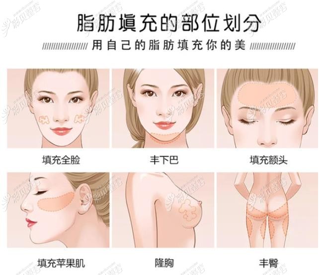 选择来福州台江医院做全脸脂肪填充不止是因为它的评价好