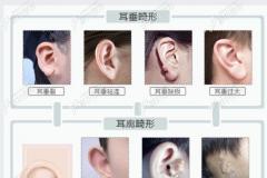 国内做耳朵畸形矫正好的医院排名,附北京,郑州耳整形价格