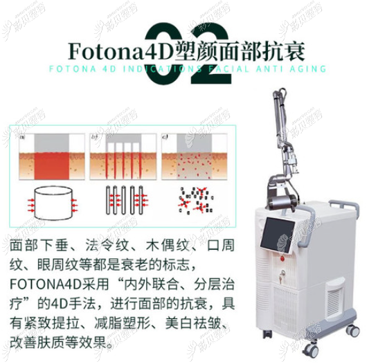 欧洲之星电波拉皮的作用原理