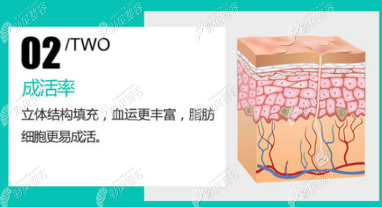 沈阳汇美人脂肪填充的优势