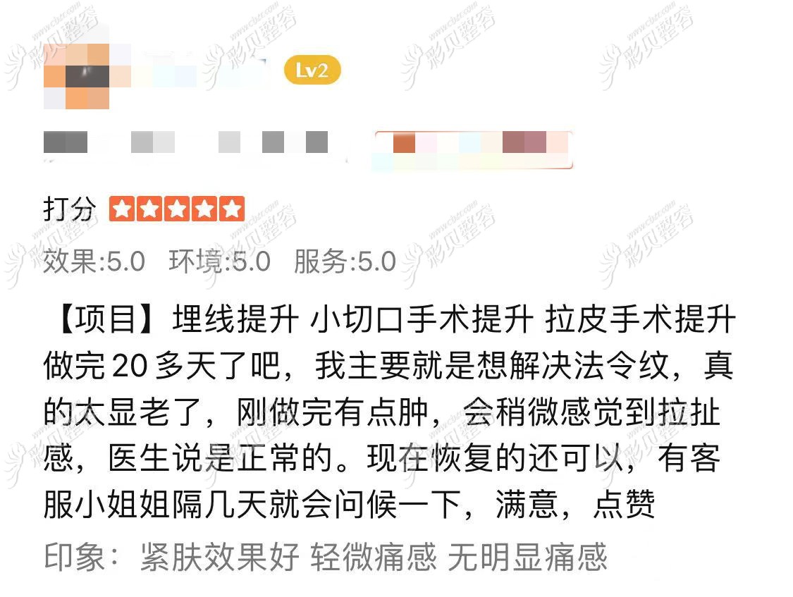 北京加减美法令纹埋线提升小切口手术拉皮手术面部提升