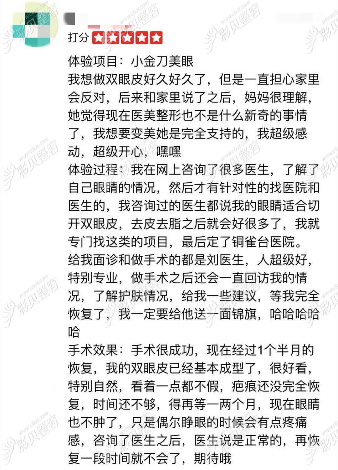云南刘哲延做双眼皮手术 云南刘哲延做双眼皮手术