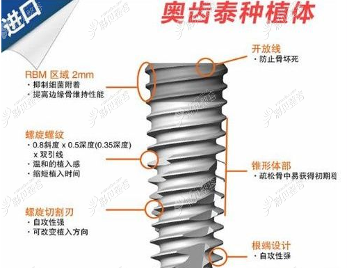 韩国奥齿泰种植体 韩国奥齿泰种植体