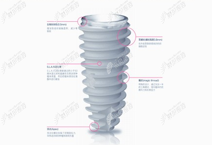 韩国纽百特neo种植体怎么样 韩国纽百特neo种植体怎么样