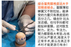 宁波失败双眼皮修复较好的医院排名，眼修复医生也有推荐