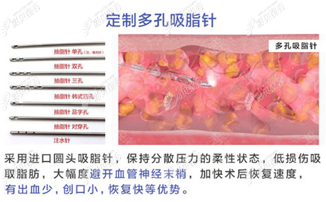 昆明韩辰王德宁医生吸脂怎么样