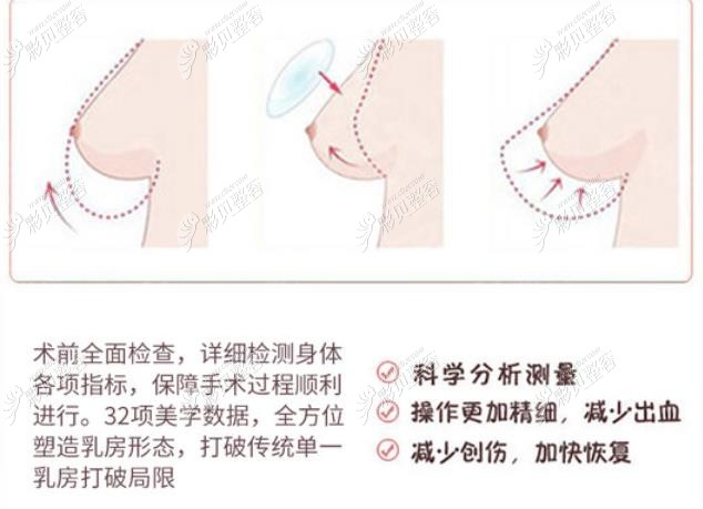 西安壹加壹丰胸怎么样，假体隆胸优势了解